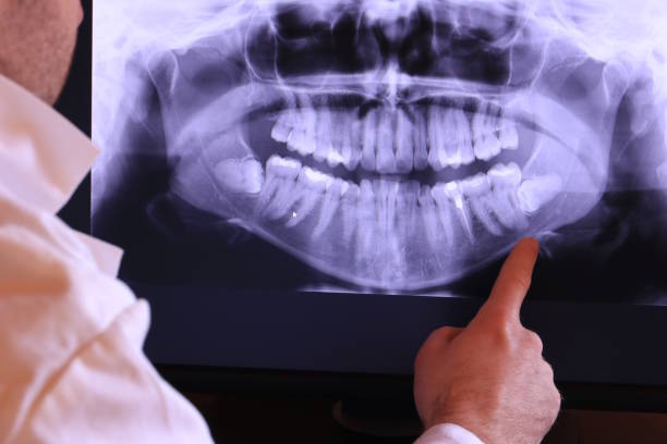 Best Emergency TMJ Treatment in Wentzville, MO