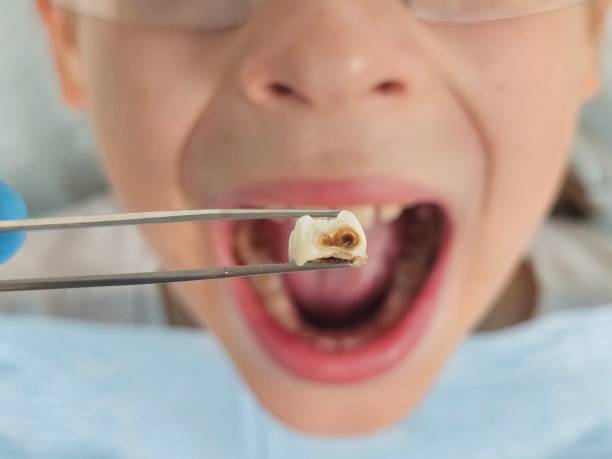 Best Cosmetic Emergency Dentistry in Wentzville, MO